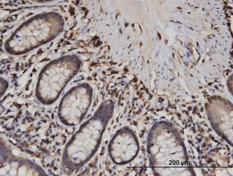 Monoclonal Anti-CAPZB, (C-terminal) antibody produced in mouse clone 1H1, purified immunoglobulin, buffered aqueous solution