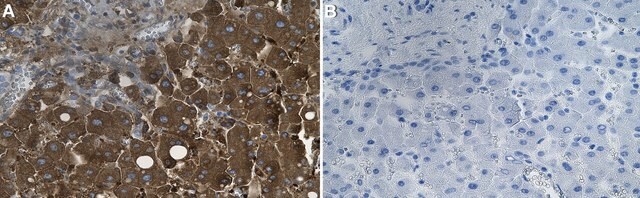 Anti-Ferritin Heavy Chain Antibody, clone 1J22 ZooMAb&#174; Rabbit Monoclonal recombinant, expressed in HEK 293 cells