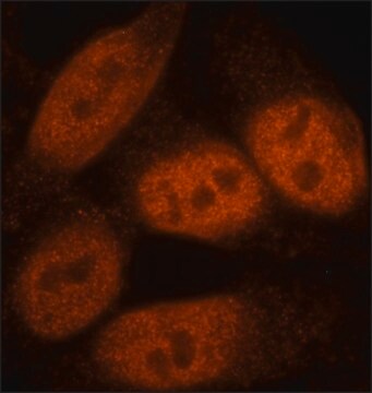 Przeciwciało anty-BCOR, mysie monoklonalne clone BR-4, purified from hybridoma cell culture