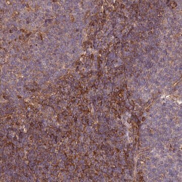 Anti-C17ORF62 antibody produced in rabbit Prestige Antibodies&#174; Powered by Atlas Antibodies, affinity isolated antibody, buffered aqueous glycerol solution