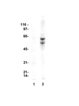 Anti-Nitrotyrosine Antibody, clone 1A6, Alexa Fluor&#8482; 488 conjugate clone 1A6, Upstate&#174;, from mouse