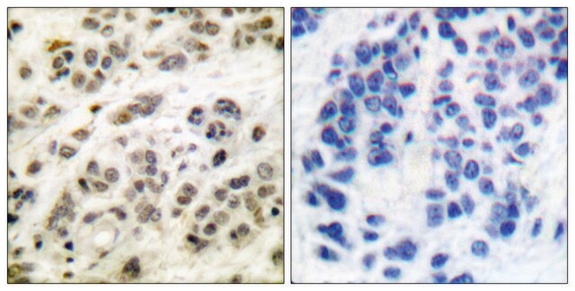 抗-MYC 兔抗 affinity isolated antibody