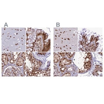 Anti-DDX1 antibody produced in rabbit Prestige Antibodies&#174; Powered by Atlas Antibodies, affinity isolated antibody, buffered aqueous glycerol solution