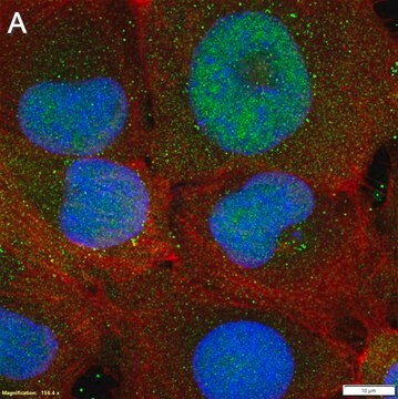 Anti-GLI-2 Antibody, clone 1G4 ZooMAb&#174; Rabbit Monoclonal recombinant, expressed in HEK 293 cells