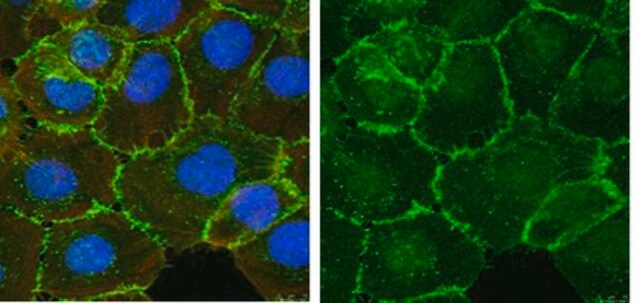 Anti-&#946;-Catenin Antibody Upstate&#174;, from rabbit