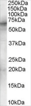 Anti-Spleen tyrosine kinase/SYK antibody produced in goat affinity isolated antibody, buffered aqueous solution