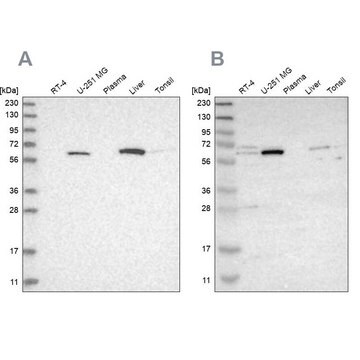 Anti-CRAT antibody produced in rabbit Prestige Antibodies&#174; Powered by Atlas Antibodies, affinity isolated antibody, buffered aqueous glycerol solution, Ab3