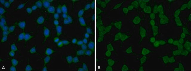 Anti-phospho-YAP1 (pTyr357) ~1.5&#160;mg/mL, affinity isolated antibody, buffered aqueous solution