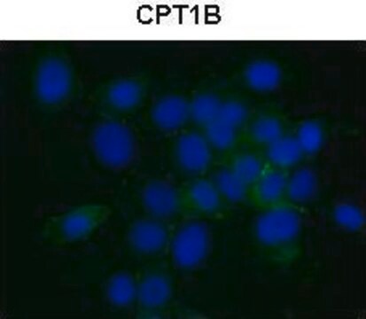 Anti-CPT1B antibody produced in rabbit affinity isolated antibody