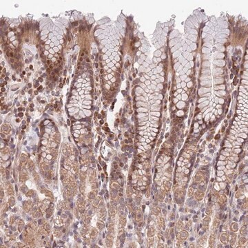 Anti-CHD9 antibody produced in rabbit Prestige Antibodies&#174; Powered by Atlas Antibodies, affinity isolated antibody, buffered aqueous glycerol solution