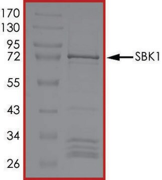 SBK1, Active PRECISIO&#174; Kinase, recombinant