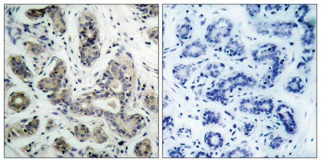 Anti-PDK1 antibody produced in rabbit affinity isolated antibody