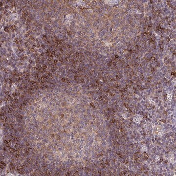 Anti-SLC9A9 antibody produced in rabbit Prestige Antibodies&#174; Powered by Atlas Antibodies, affinity isolated antibody, buffered aqueous glycerol solution