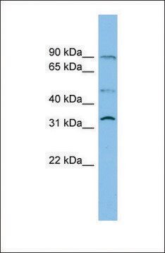 抗SLC27A3抗体 ウサギ宿主抗体 affinity isolated antibody