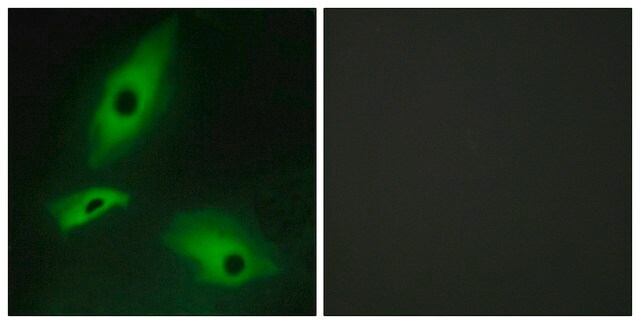 Anti-LTBR antibody produced in rabbit affinity isolated antibody