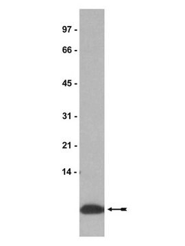 Anticorpo anti-IGF-II, clone S1F2 clone S1F2, Upstate&#174;, from mouse