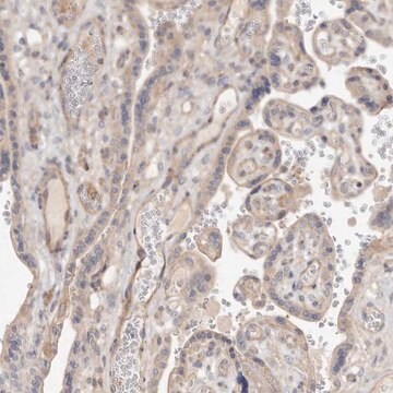 Anti-ADAMTS9 antibody produced in rabbit Prestige Antibodies&#174; Powered by Atlas Antibodies, affinity isolated antibody, buffered aqueous glycerol solution, ab2