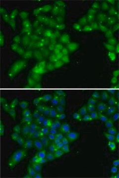 Anti-GCK antibody produced in rabbit