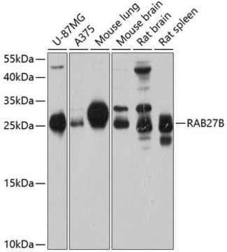 Anti-RAB27B antibody produced in rabbit