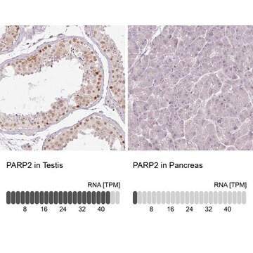 抗PARP2抗体 ウサギ宿主抗体 Prestige Antibodies&#174; Powered by Atlas Antibodies, affinity isolated antibody, buffered aqueous glycerol solution