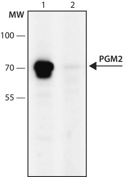 Anti-PGM2 (596-610) antibody produced in rabbit IgG fraction of antiserum