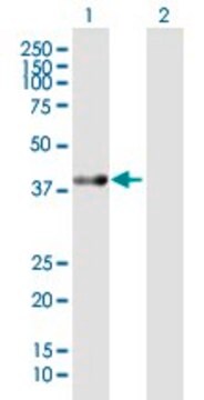 Anti-ACAT2 antibody produced in mouse purified immunoglobulin, buffered aqueous solution