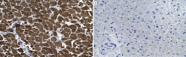 Anti-Cardiac Troponin T Antibody, clone 1G6 ZooMAb&#174; Rabbit Monoclonal recombinant, expressed in HEK 293 cells