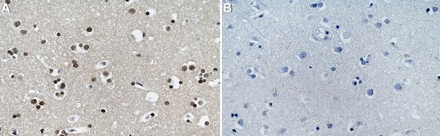 Anti-Histone H2A Antibody, clone 1O19 ZooMAb&#174; Rabbit Monoclonal recombinant, expressed in HEK 293 cells