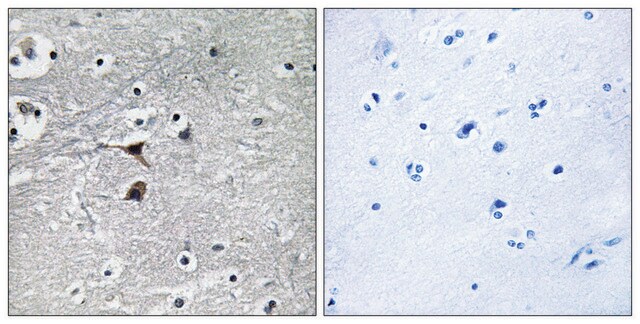 Anti-Tryptophan Hydroxylase antibody produced in rabbit affinity isolated antibody