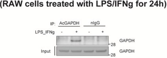 Anti-acetyl-GAPDH (Lys160) Antibody 0.5&#160;mg/mL, from rabbit