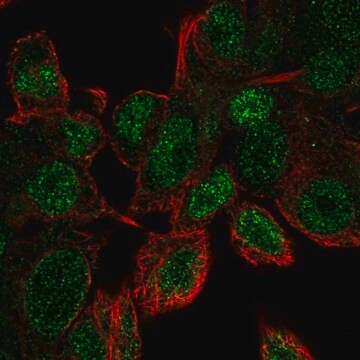 Anti-UBE2V1 antibody produced in rabbit Prestige Antibodies&#174; Powered by Atlas Antibodies, affinity isolated antibody