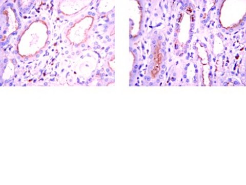 Anti-BMP-7 Antibody, clone 2A10 clone 2A10, from mouse