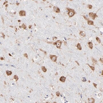 Anti-RPL3 antibody produced in rabbit Prestige Antibodies&#174; Powered by Atlas Antibodies, affinity isolated antibody, buffered aqueous glycerol solution