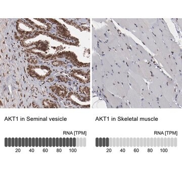 抗AKT1抗体 ウサギ宿主抗体 Prestige Antibodies&#174; Powered by Atlas Antibodies, affinity isolated antibody, buffered aqueous glycerol solution