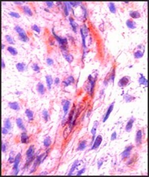 Anti-CSF1 antibody produced in rabbit affinity isolated antibody