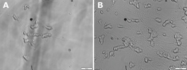 Fator neurotrófico derivado do cérebro BDNF, recombinant, expressed in E. coli, lyophilized powder, suitable for cell culture