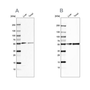 Anti-GC antibody produced in rabbit Prestige Antibodies&#174; Powered by Atlas Antibodies, affinity isolated antibody, buffered aqueous glycerol solution