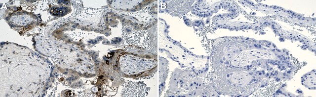 Anti-PAI-1 Antibody, clone 1C11 ZooMAb&#174; Rabbit Monoclonal recombinant, expressed in HEK 293 cells