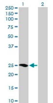 Anti-MRAS antibody produced in mouse purified immunoglobulin, buffered aqueous solution