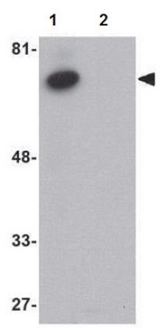 Przeciwciało anty-ACVR1B from rabbit, purified by affinity chromatography