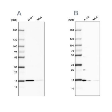 Anti-CCDC58 antibody produced in rabbit Prestige Antibodies&#174; Powered by Atlas Antibodies, affinity isolated antibody, buffered aqueous glycerol solution