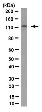 Anticuerpo anti-SREBP-2, clon 22D5 clone 22D5, from rabbit