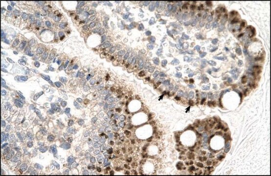 Anti-ZFP1 affinity isolated antibody