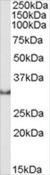 抗オステオポンチン/SPP1抗体 ヤギ宿主抗体 affinity isolated antibody, buffered aqueous solution