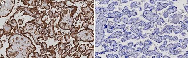 Anti-GLUT-1 Antibody, CT from rabbit, purified by affinity chromatography