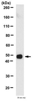 Anti-Tau, a.a. 210-241 Antibody, clone Tau-5 clone TAU-5, from mouse