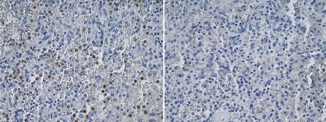 Anti-CXCR2/IL-8RB Antibody, clone 2D18 ZooMAb&#174; Rabbit Monoclonal recombinant, expressed in HEK 293 cells