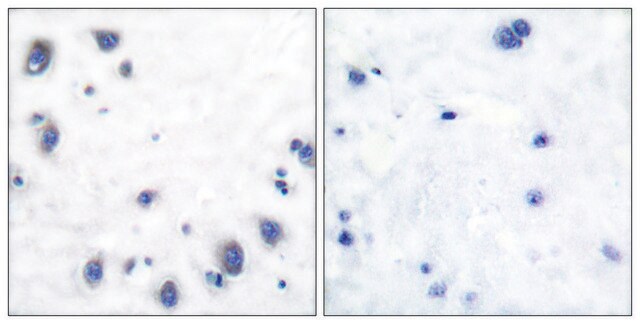 Anti-Tyrosine Hydroxylase, N-Terminal antibody produced in rabbit affinity isolated antibody