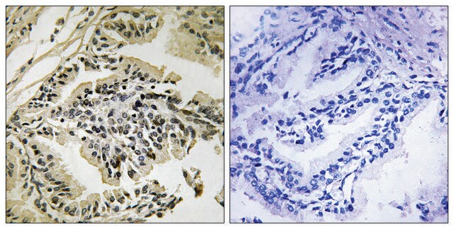 Anti-phospho-PEK/PERK (pThr981) antibody produced in rabbit affinity isolated antibody