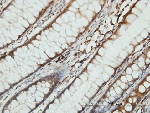 Monoclonal Anti-SARS antibody produced in mouse clone 1H4, purified immunoglobulin, buffered aqueous solution